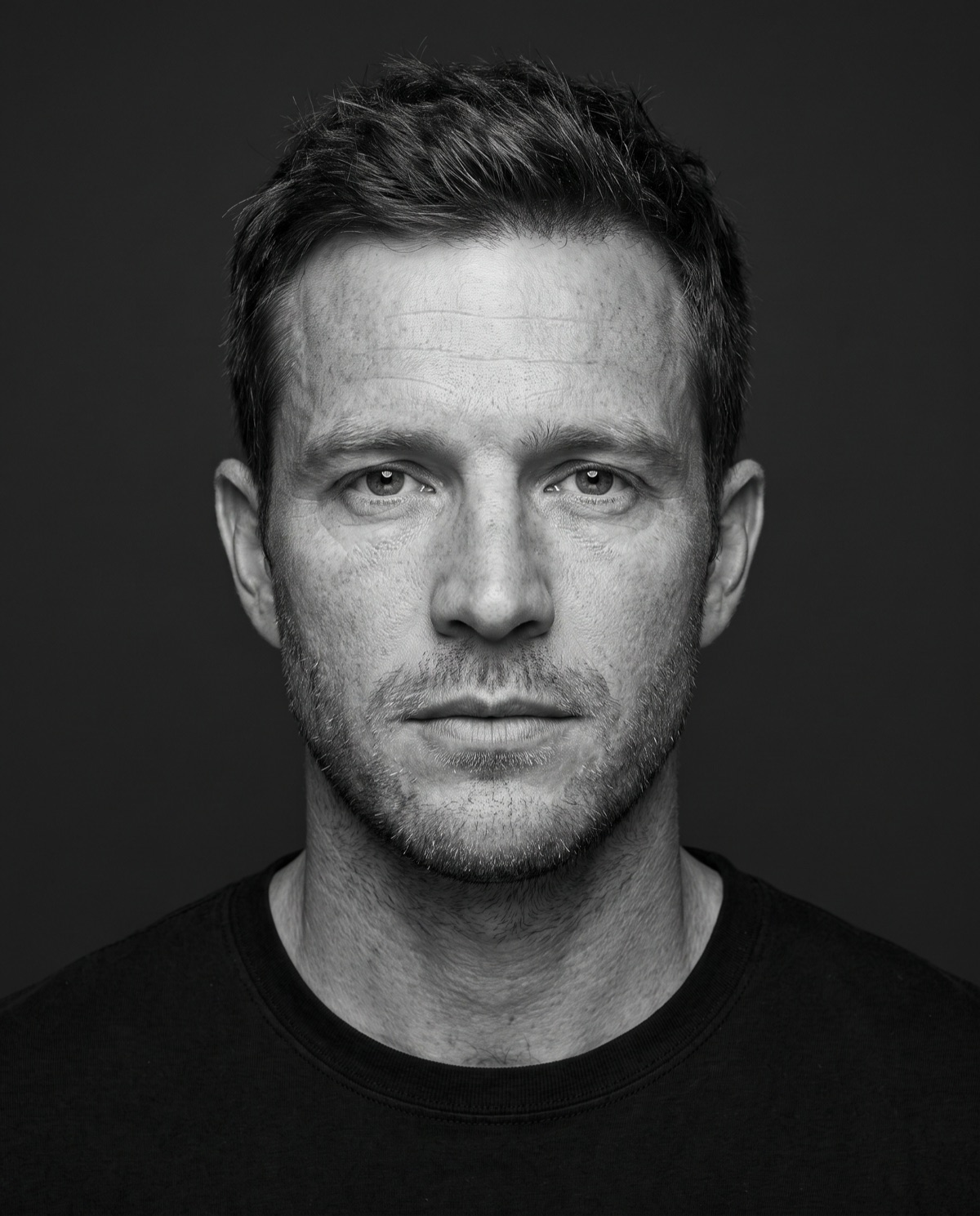 Front-facing portrait with the application points marked